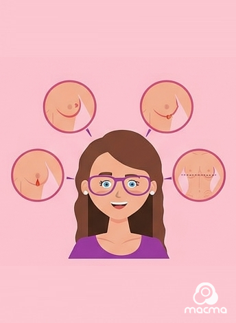 Paso 4 del autoexamen mamario